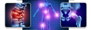 Human body joint pain concept as skeleton and muscle anatomy of the body with a group of sore joints as a painful injury or arthritis illness symbol for health care and medical symptoms with 3D illustration elements.